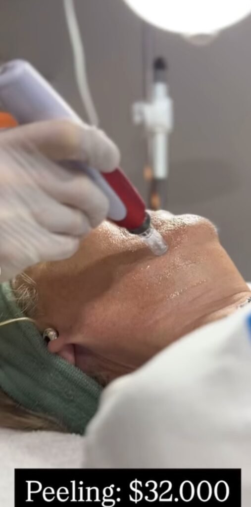 Limpieza o tratamiento faciales