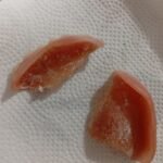ARREGLO DE PRÓTESIS DENTALES