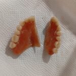 ARREGLO DE PRÓTESIS DENTALES