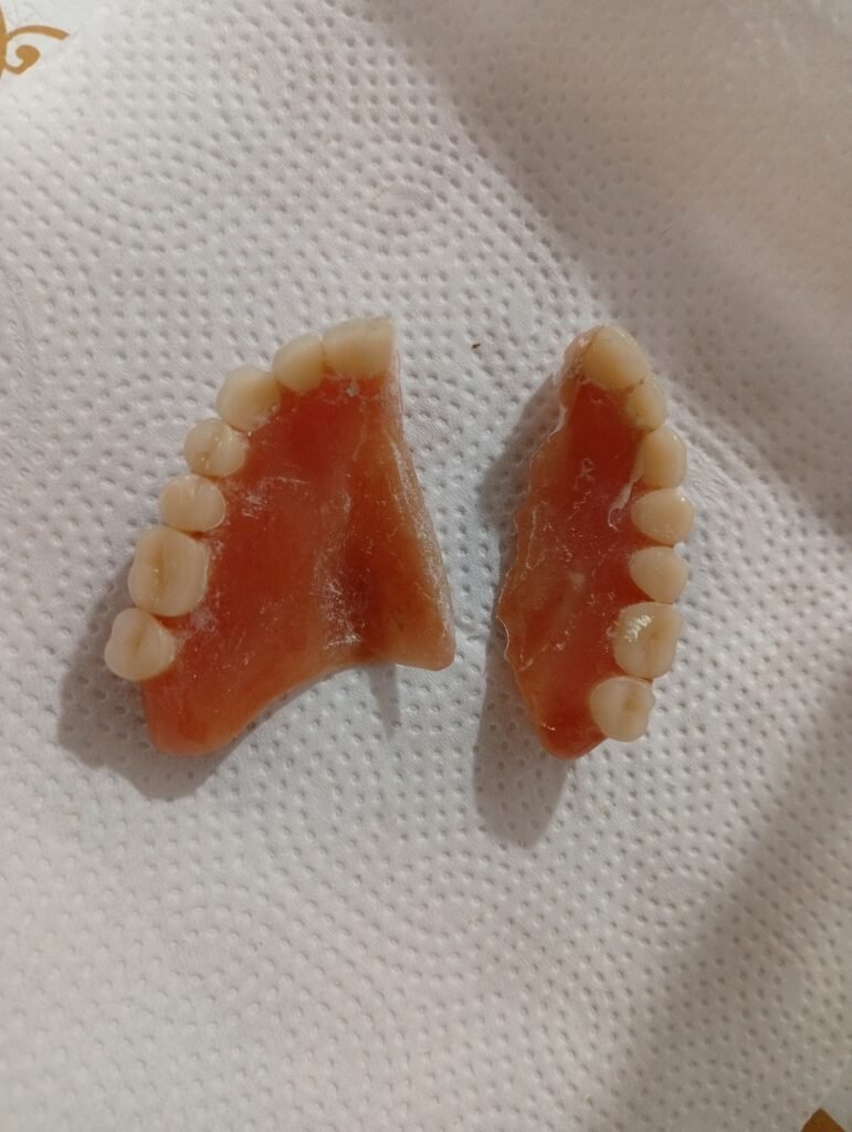 ARREGLO DE PRÓTESIS DENTALES