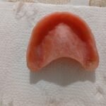 ARREGLO DE PRÓTESIS DENTALES