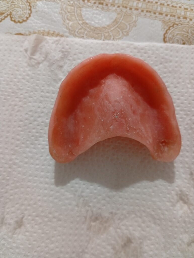 ARREGLO DE PRÓTESIS DENTALES