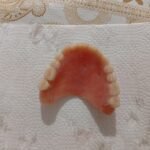 ARREGLO DE PRÓTESIS DENTALES