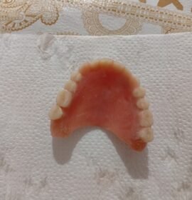 ARREGLO DE PRÓTESIS DENTALES