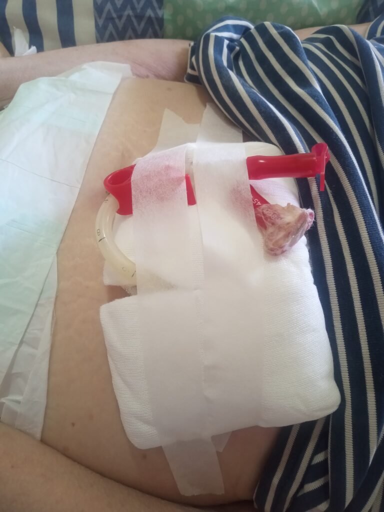 Auxiliar gereantologico. ( Cuidador de adultos mayores)
